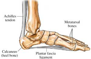 plantar fascia enthesophyte